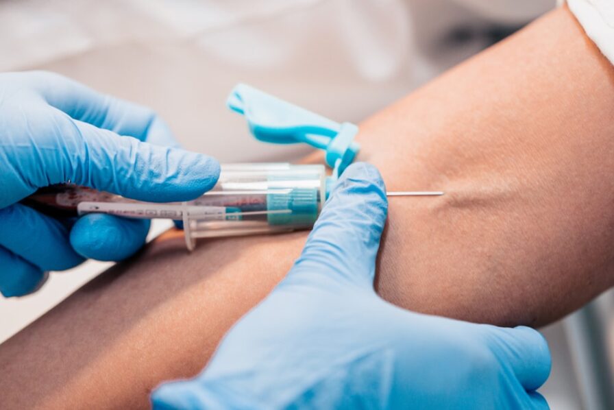 What is Phlebotomy, and Why Might You Need It? Miles Pharmacy Explains