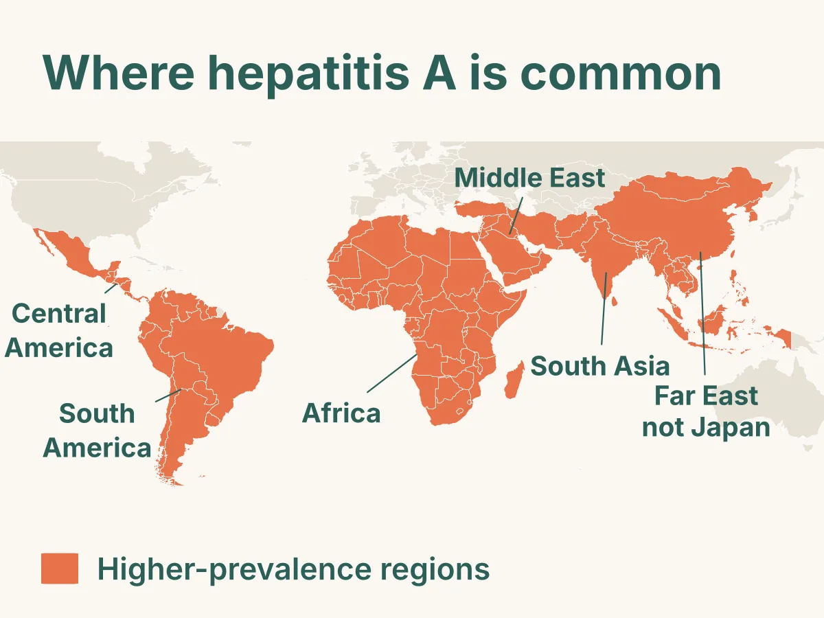 World map of higher-prevalence regions for hepatitis A: Central and South America, Africa, the Middle East, South Asia and the Far East apart from Japan.